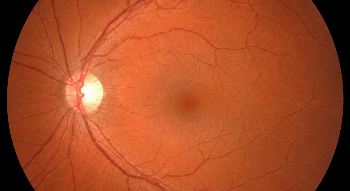 AI rendering of a healthy retina (fundus photo)