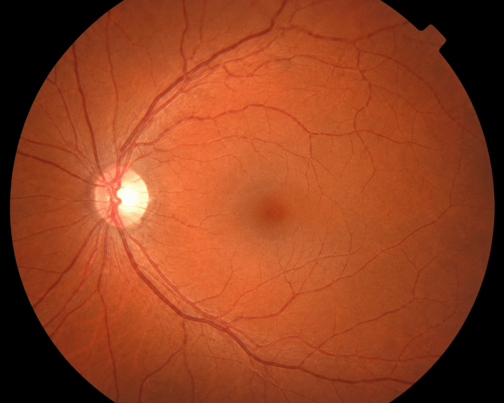 AI rendering of a healthy retina (fundus photo)